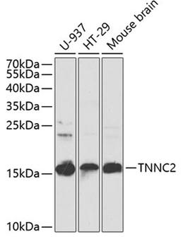 Western blot - TNNC2 antibody (A7740)