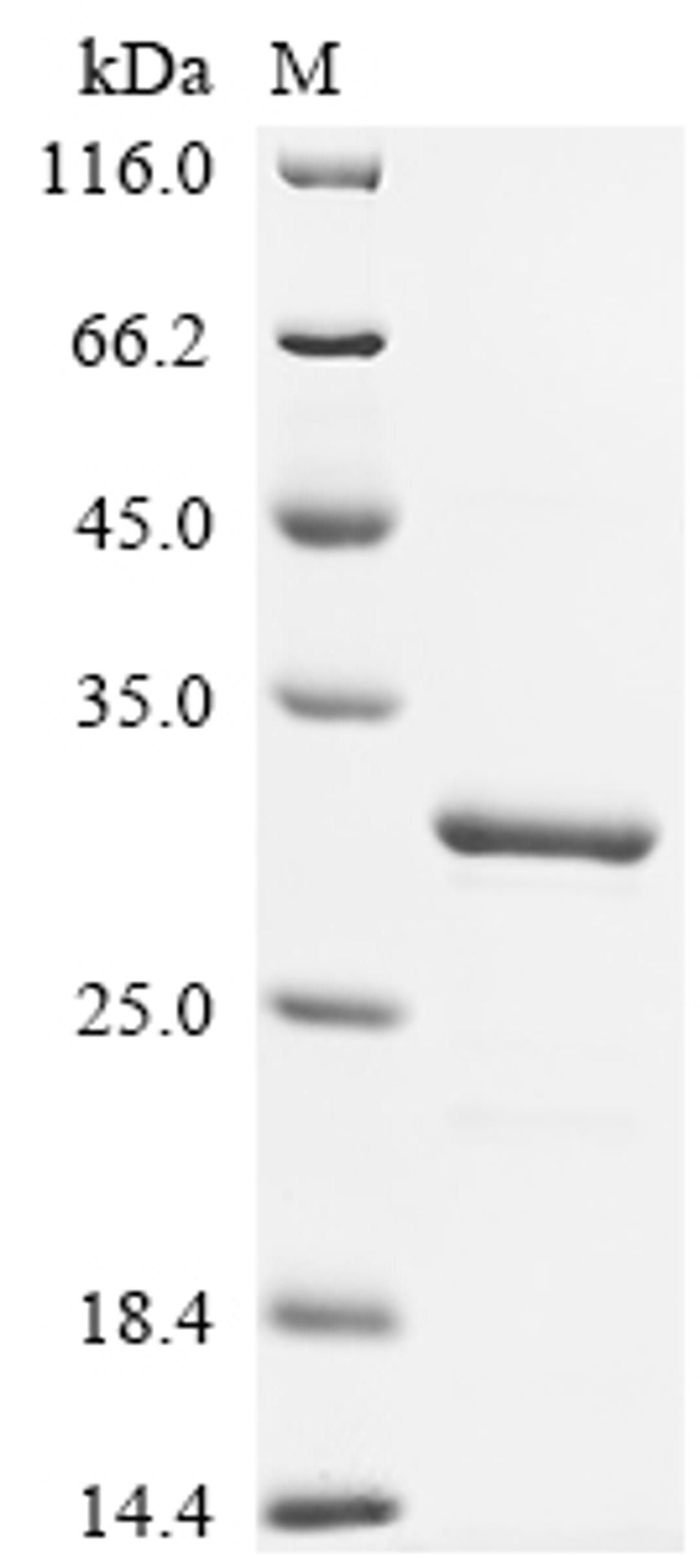(Tris-Glycine gel) Discontinuous SDS-PAGE (reduced) with 5% enrichment gel and 15% separation gel.