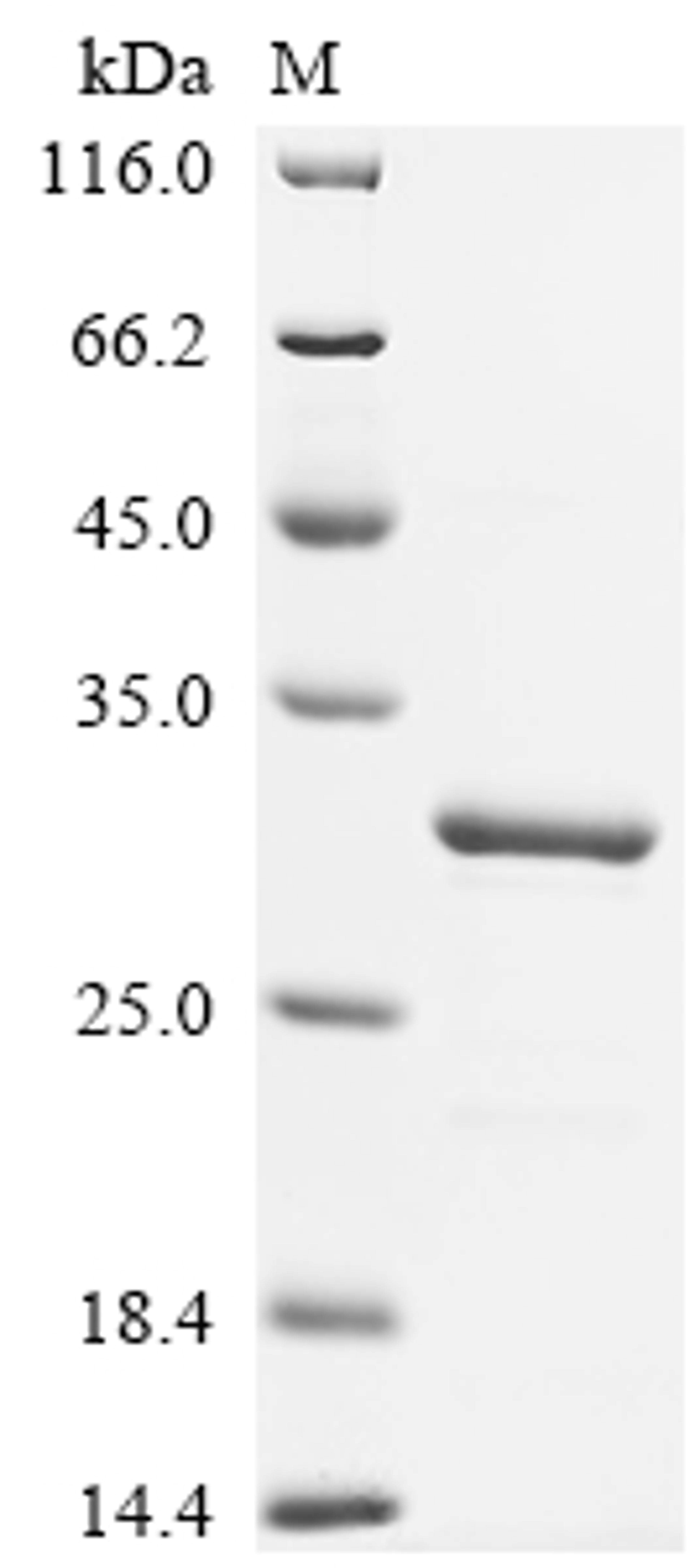 (Tris-Glycine gel) Discontinuous SDS-PAGE (reduced) with 5% enrichment gel and 15% separation gel.