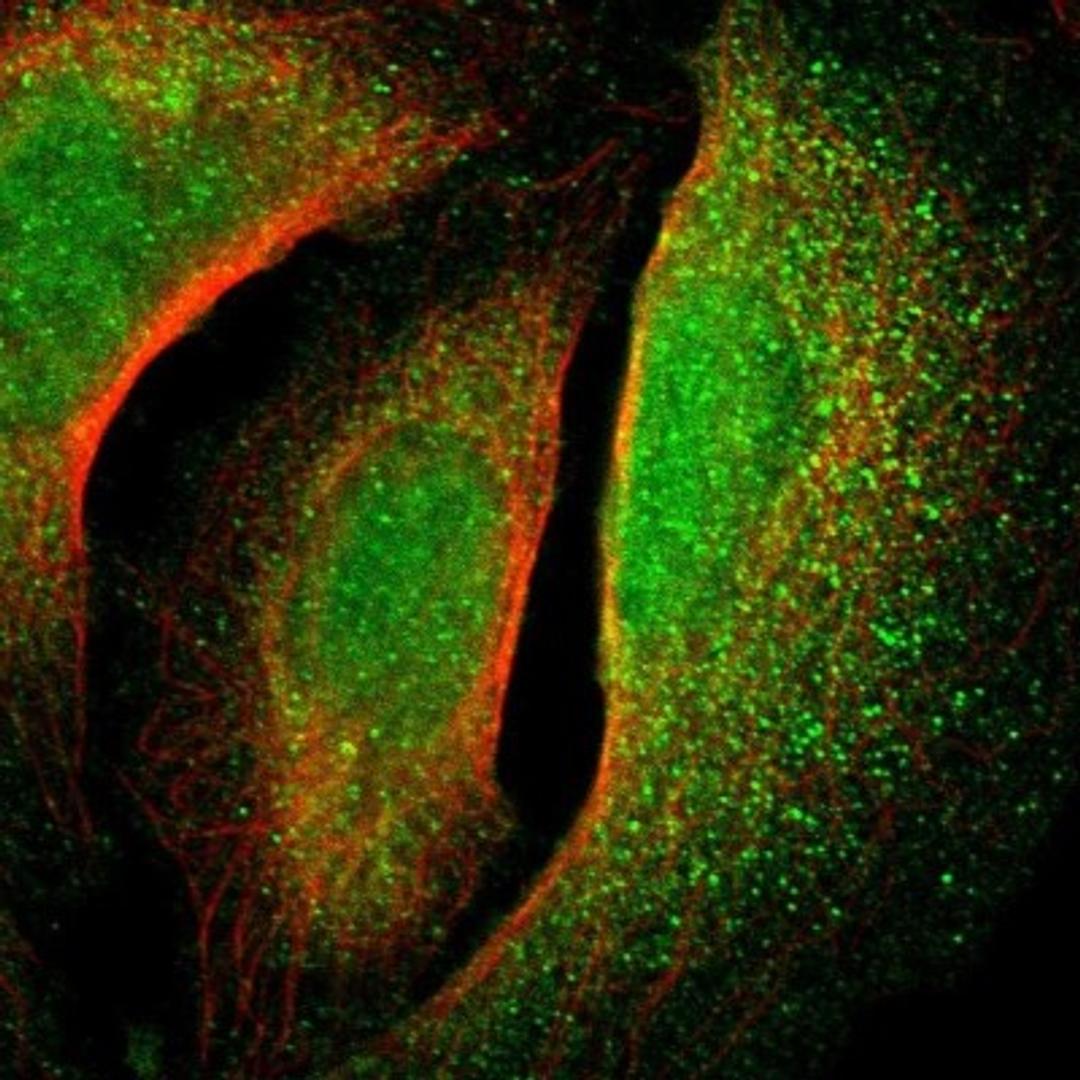 Immunocytochemistry/Immunofluorescence: NUAK2 Antibody [NBP1-81880] - Staining of human cell line U-2 OS shows positivity in nucleus & cytoplasm.