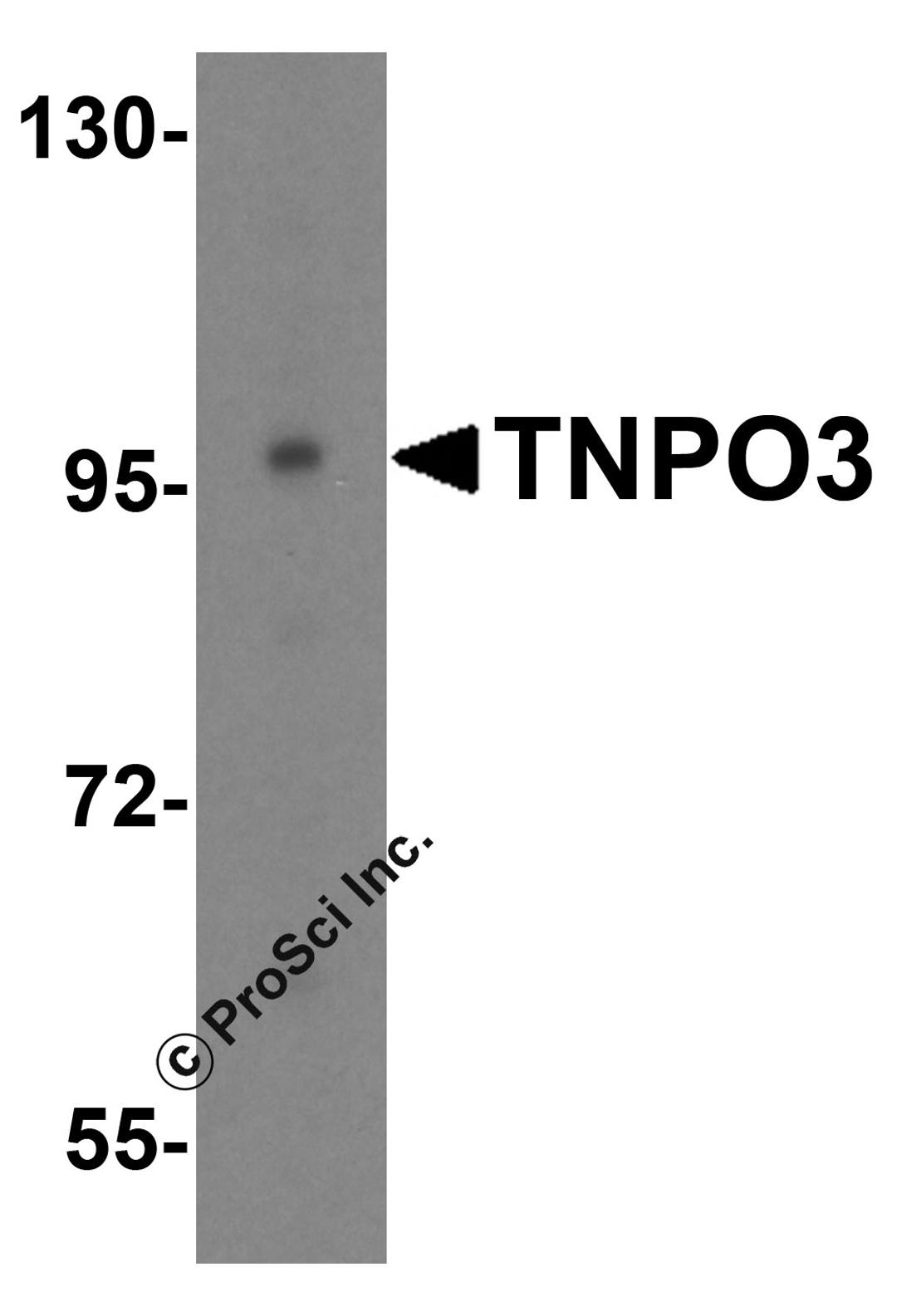 Western blot analysis of TNPO3 in HeLa cell lysate with TNPO3 antibody at 0.5 μg/mL.