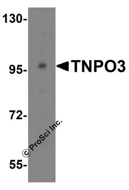 Western blot analysis of TNPO3 in HeLa cell lysate with TNPO3 antibody at 0.5 μg/mL.