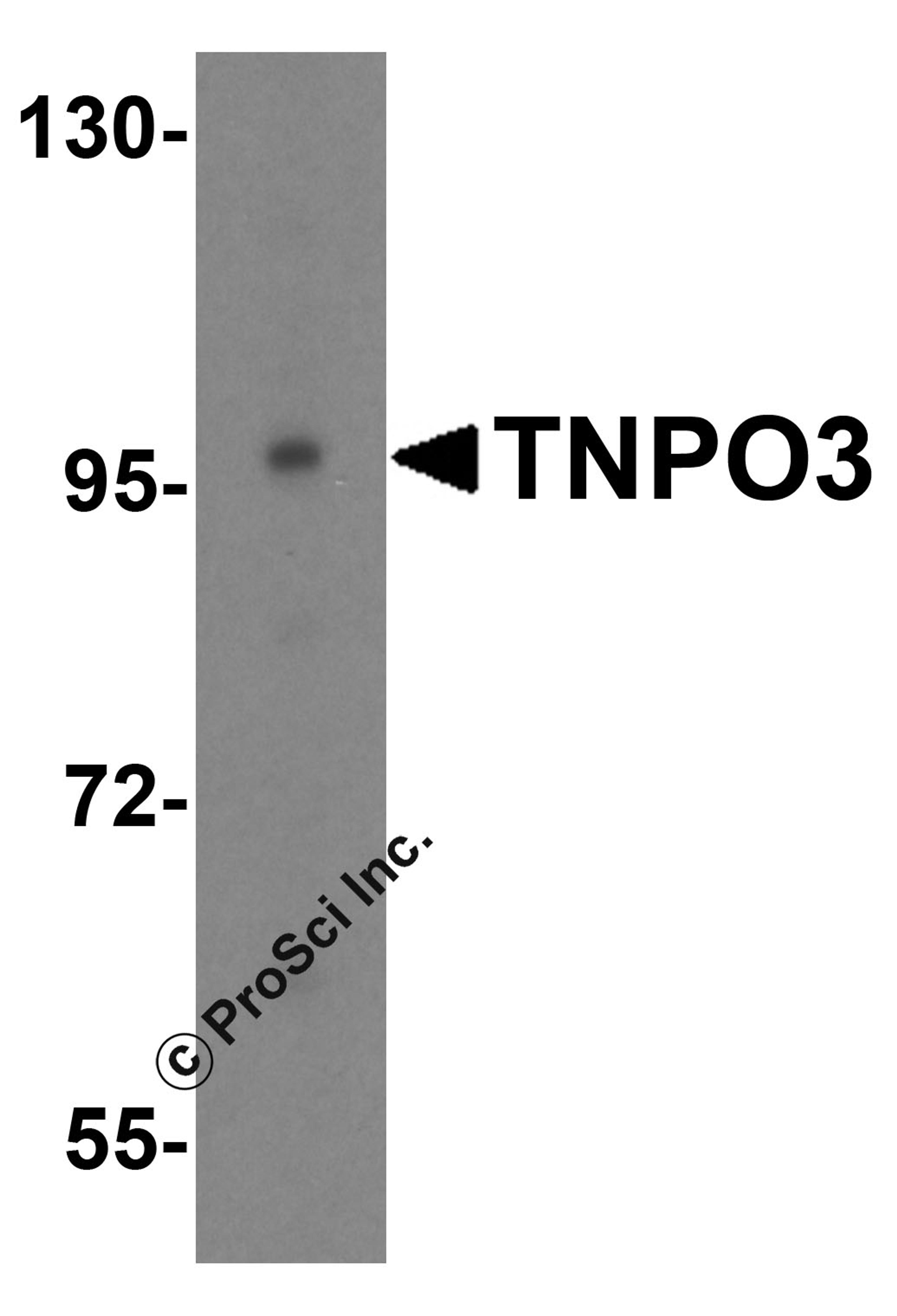 Western blot analysis of TNPO3 in HeLa cell lysate with TNPO3 antibody at 0.5 μg/mL.