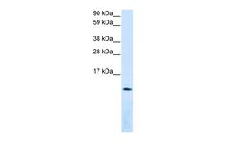 Antibody used in WB on Human Lung at 0.2-1 ug/ml.