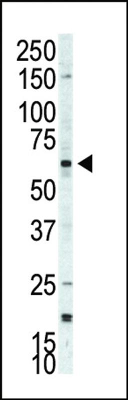 Western blot analysis of anti-p70S6Kbeta Pab in A375 cell lysate. p70S6Kbeta was detected using purified Pab.