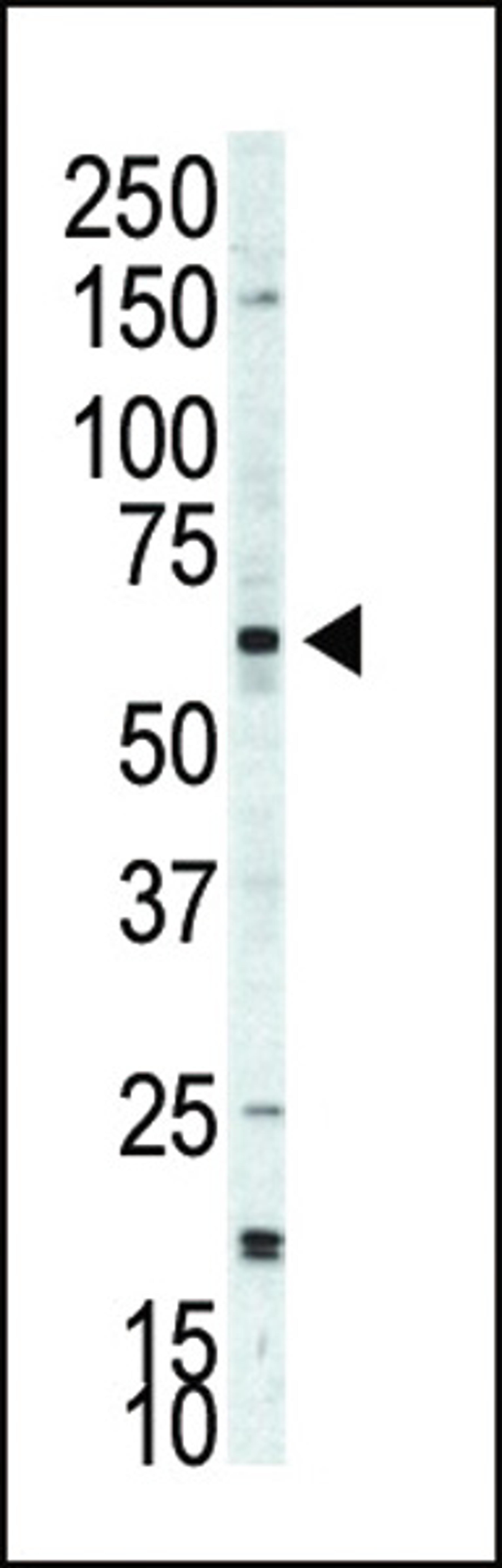 Western blot analysis of anti-p70S6Kbeta Pab in A375 cell lysate. p70S6Kbeta was detected using purified Pab.