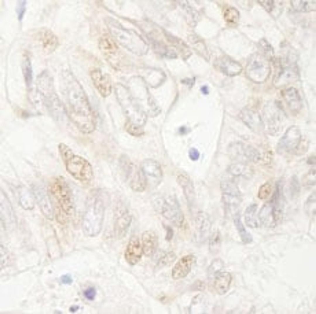 Detection of human APC by immunohistochemistry.