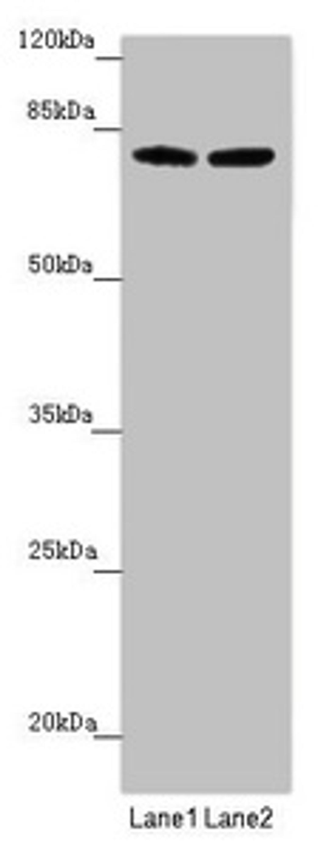 Western blot. All lanes: FBXL5 antibody at 1.51 ug/ml. Lane 1: Mouse lung tissue. Lane 2: Mouse gonadal tissue. Secondary. Goat polyclonal to rabbit IgG at 1/10000 dilution. Predicted band size: 79, 77 kDa. Observed band size: 79, 95 kDa. 