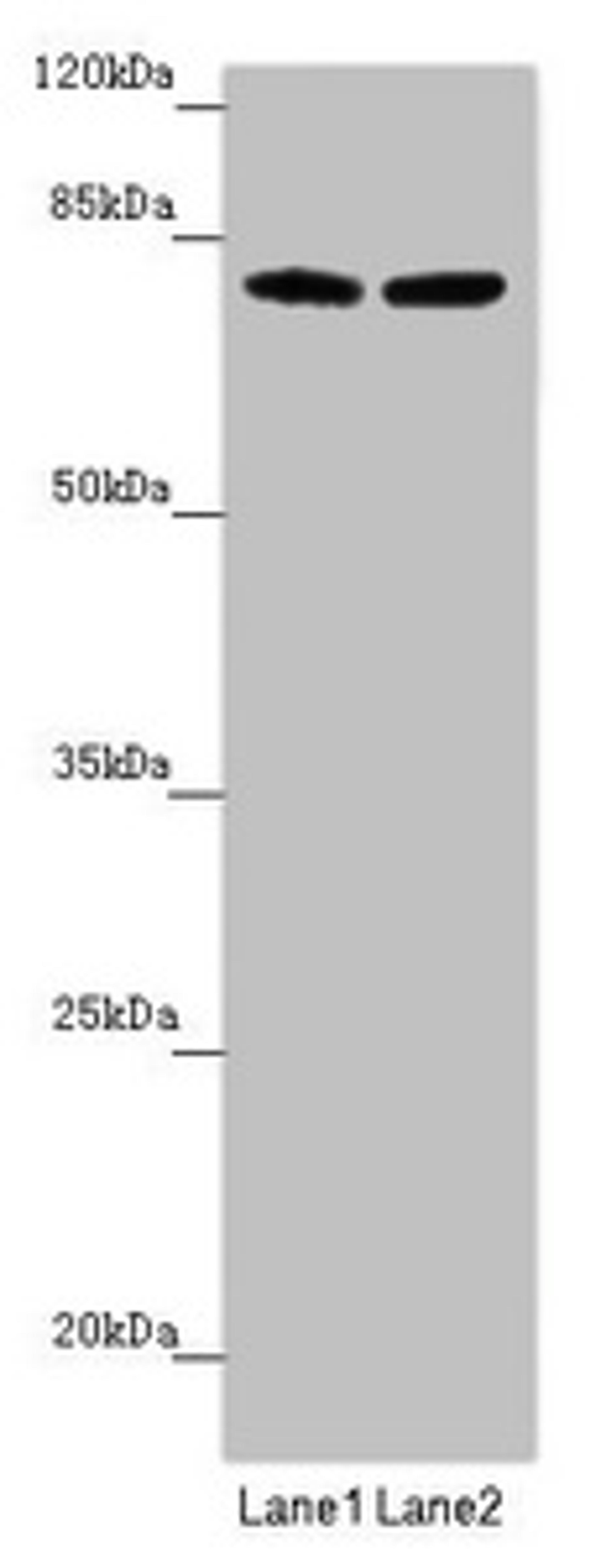 Western blot. All lanes: FBXL5 antibody at 1.51 ug/ml. Lane 1: Mouse lung tissue. Lane 2: Mouse gonadal tissue. Secondary. Goat polyclonal to rabbit IgG at 1/10000 dilution. Predicted band size: 79, 77 kDa. Observed band size: 79, 95 kDa. 