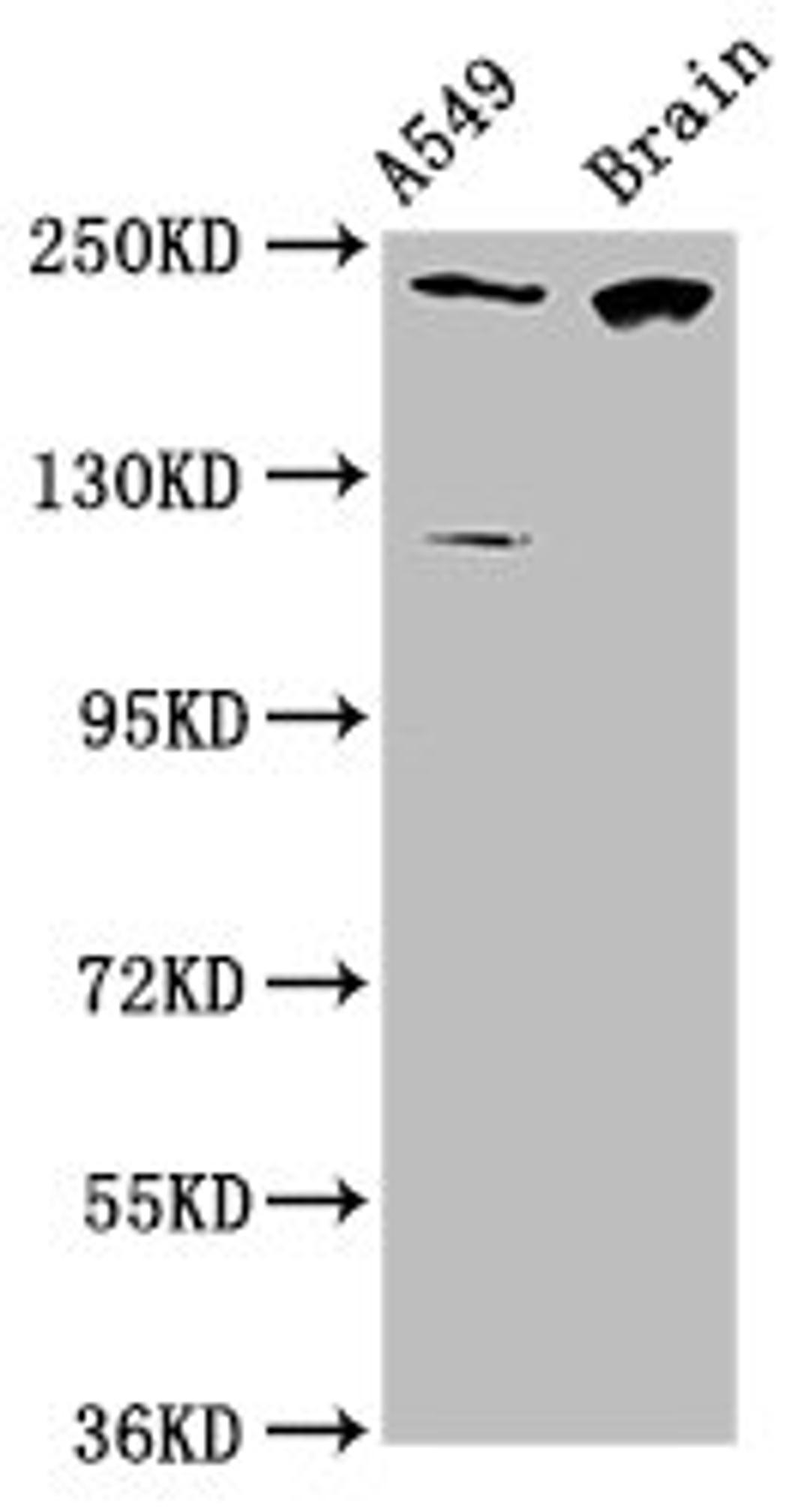 Western Blot. Positive WB detected in: A549 whole cell lysate, Rat brain tissue. All lanes: CABIN1 antibody at 3.1µg/ml. Secondary. Goat polyclonal to rabbit IgG at 1/50000 dilution. Predicted band size: 247, 238 kDa. Observed band size: 247 kDa