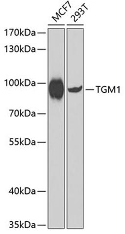 Western blot - TGM1 antibody (A7343)