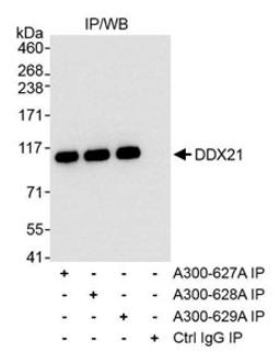 Detection of human DDX21 by western blot of immunoprecipitates.