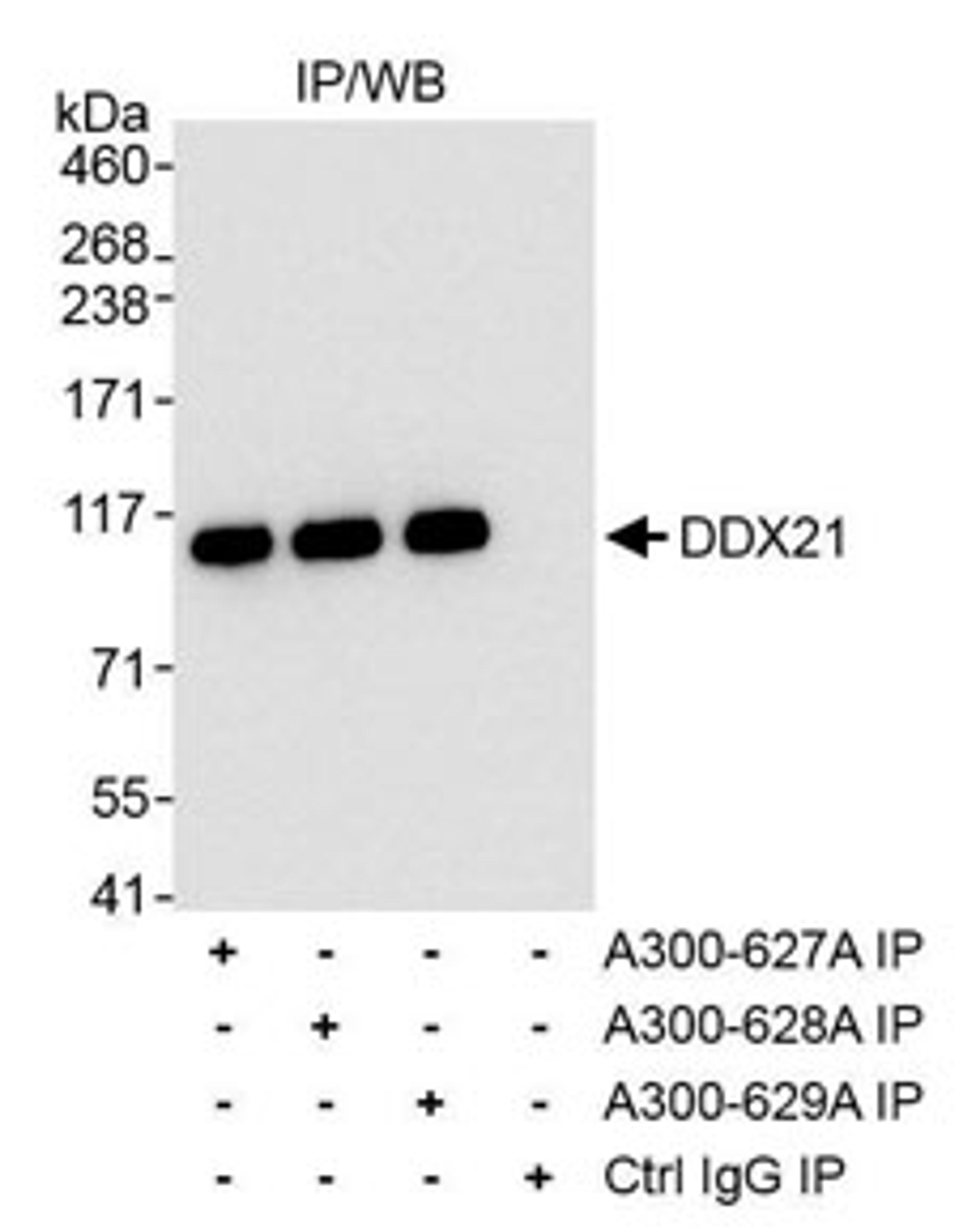 Detection of human DDX21 by western blot of immunoprecipitates.