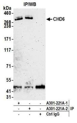 Detection of human CHD6 by western blot of immunoprecipitates.