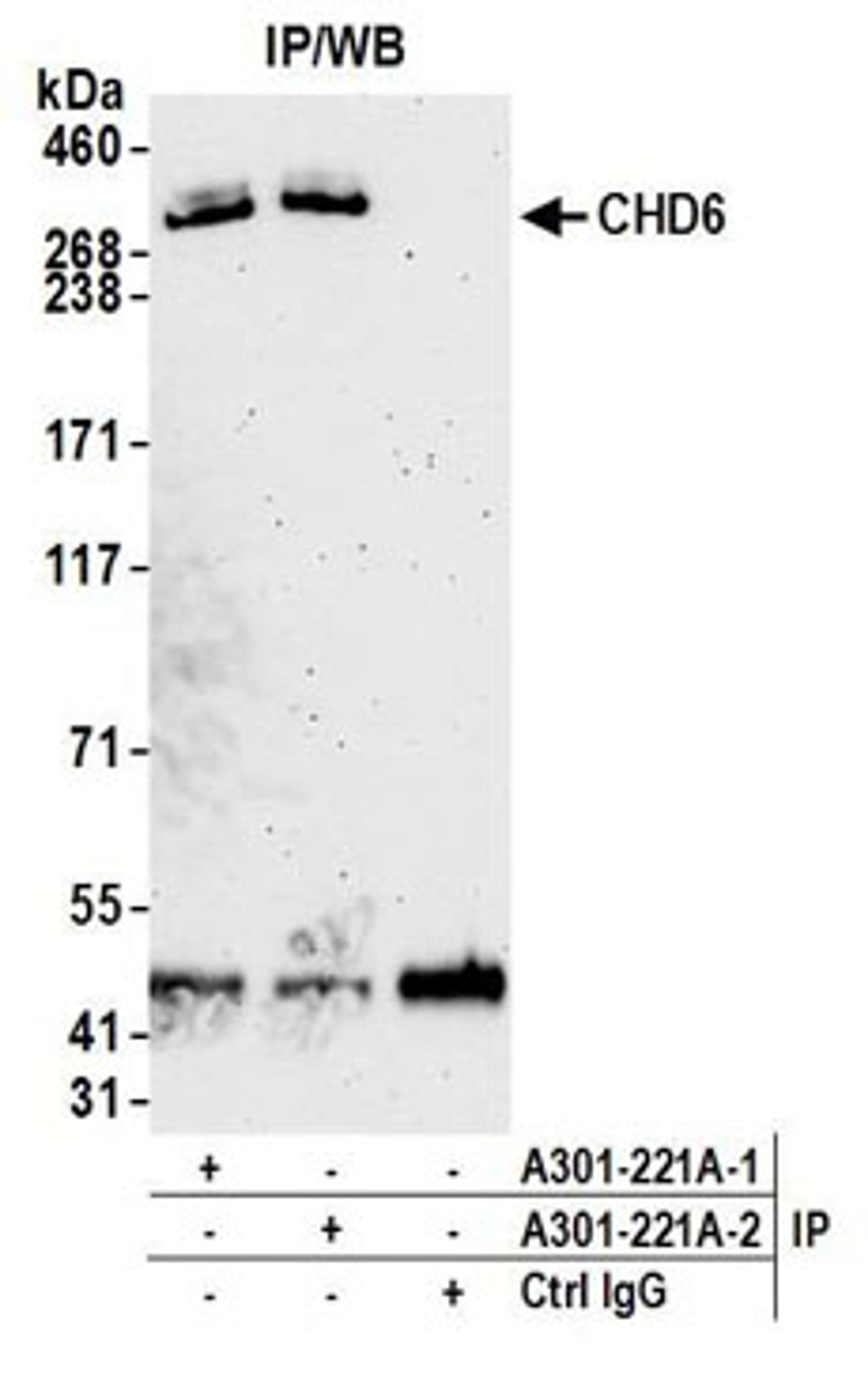 Detection of human CHD6 by western blot of immunoprecipitates.