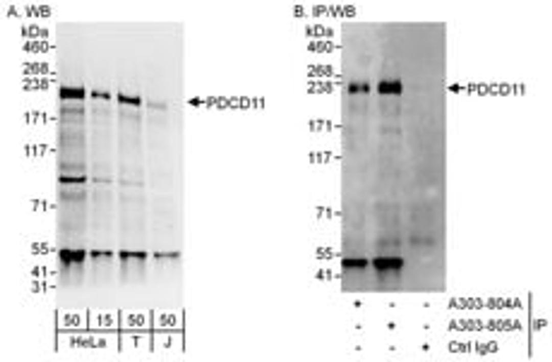 Detection of human PDCD11 by western blot and immunoprecipitation.