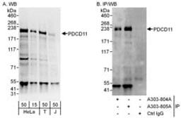 Detection of human PDCD11 by western blot and immunoprecipitation.