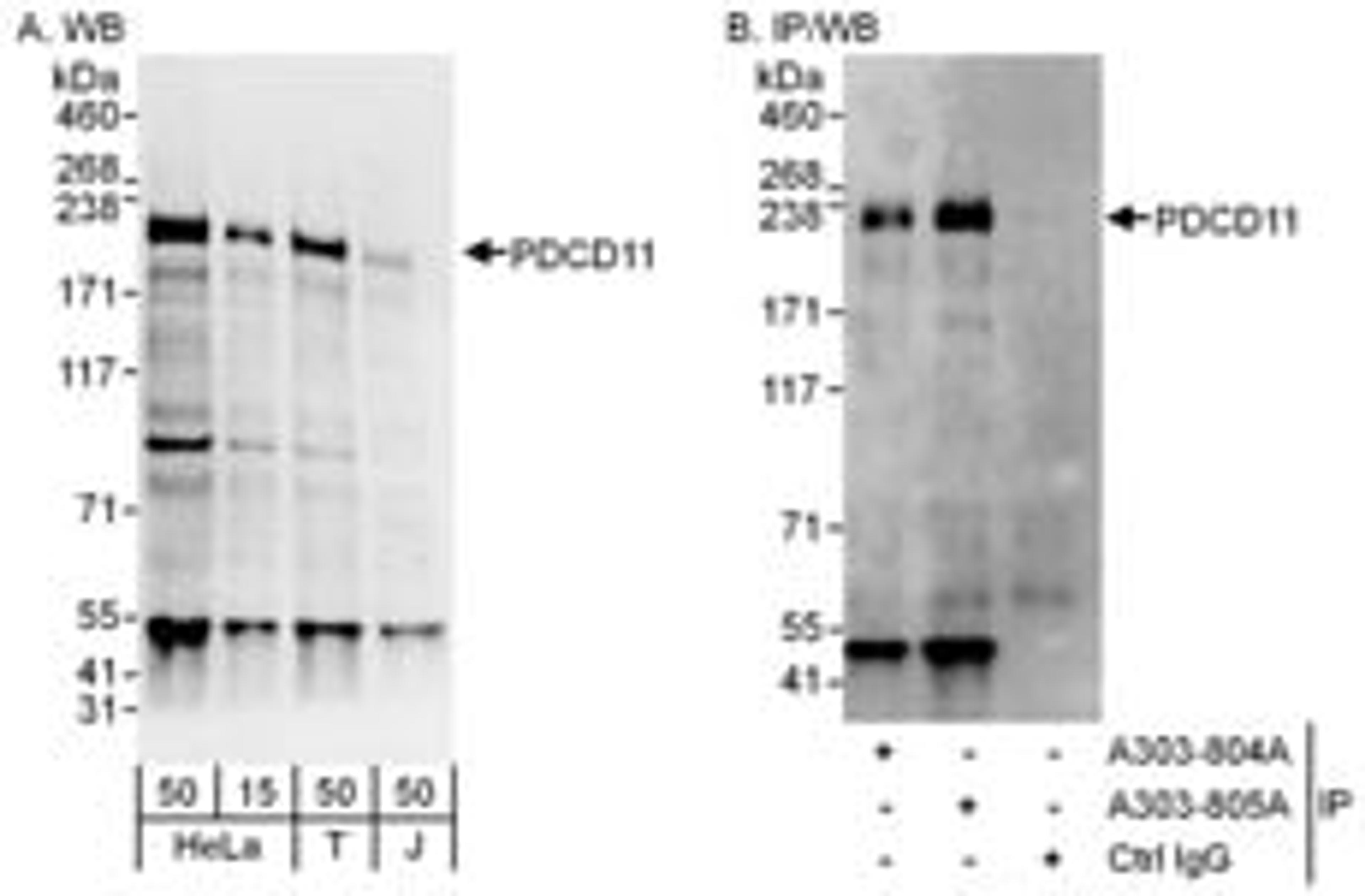 Detection of human PDCD11 by western blot and immunoprecipitation.