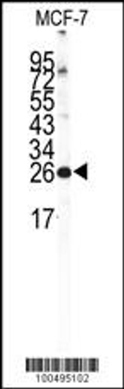 Western blot analysis of NCS1 Antibody in MCF-7 cell line lysates (35ug/lane)