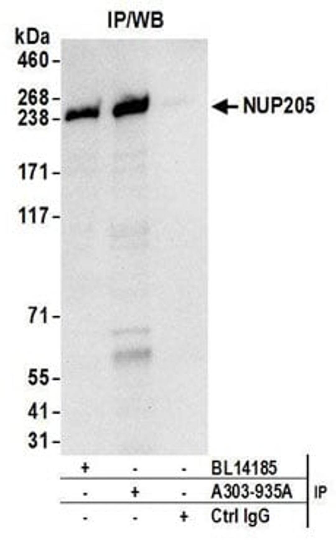 Detection of human NUP205 by western blot of immunoprecipitates.