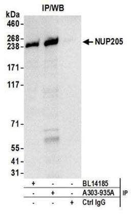 Detection of human NUP205 by western blot of immunoprecipitates.