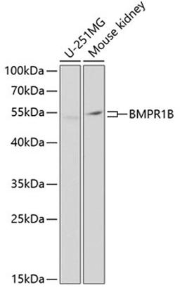 Western blot - BMPR1B Antibody (A2005)