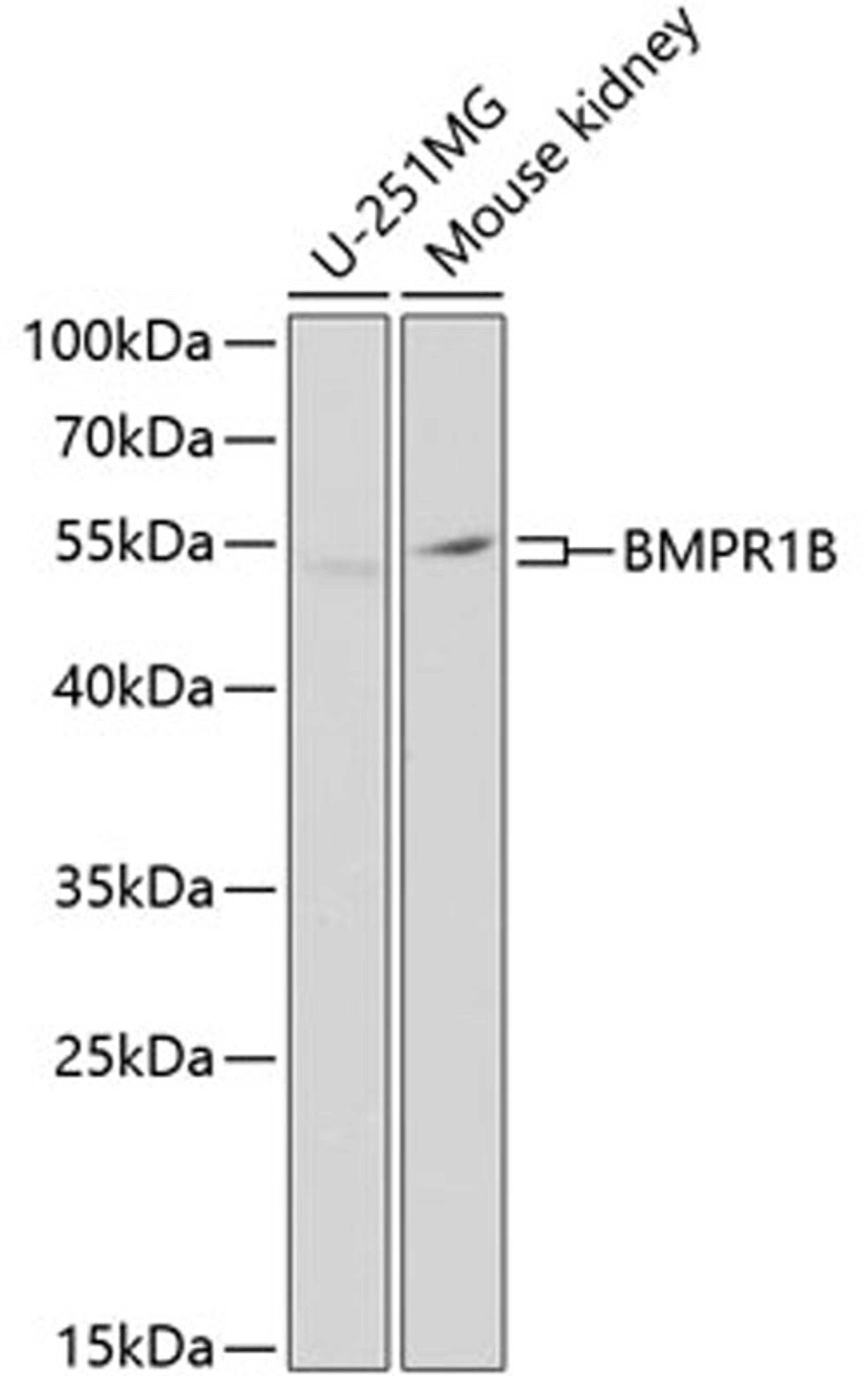 Western blot - BMPR1B Antibody (A2005)