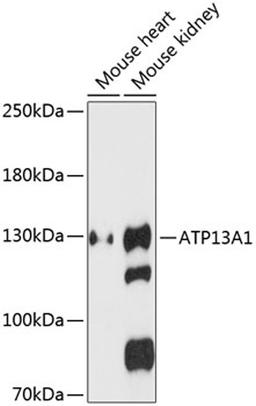 Western blot - ATP13A1 antibody (A13900)