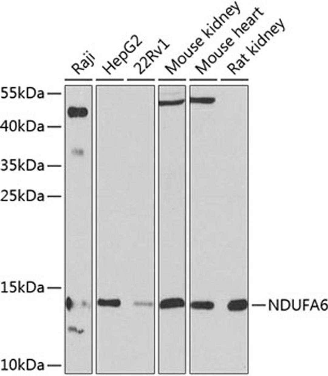 Western blot - NDUFA6 antibody (A9831)