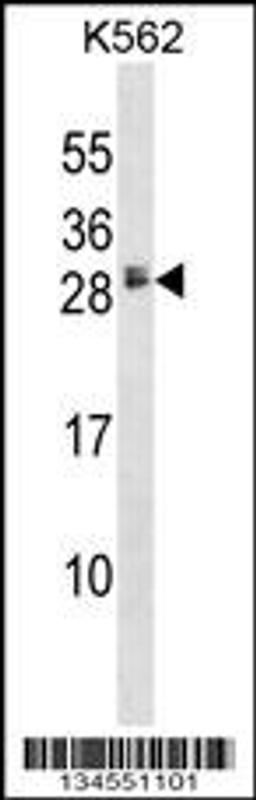 Western blot analysis in K562 cell line lysates (35ug/lane).