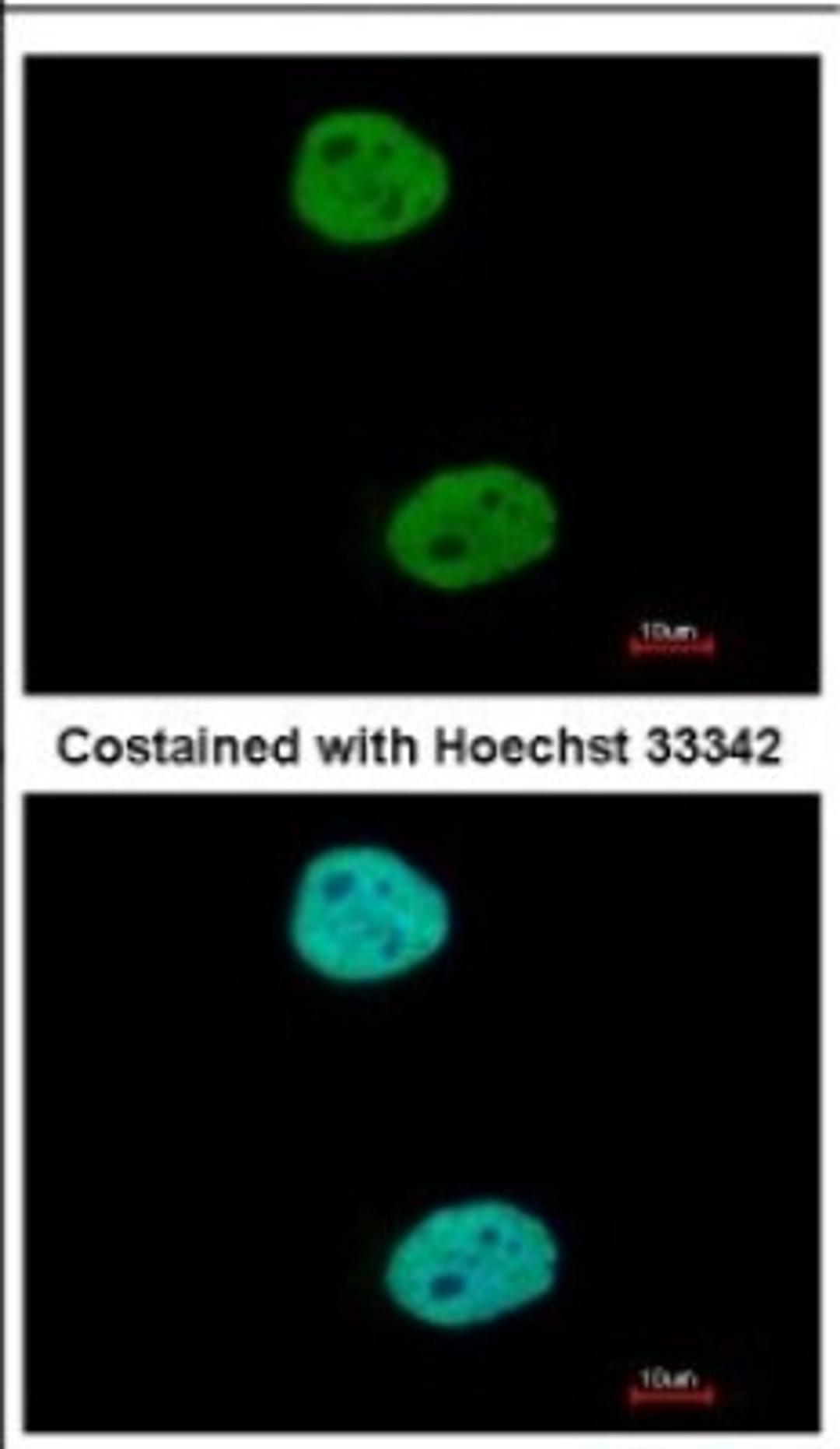 Immunocytochemistry/Immunofluorescence: GTF3C4 Antibody [NBP2-16763] - Immunofluorescence analysis of paraformaldehyde-fixed HeLa, using antibody at 1:500 dilution.