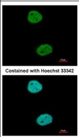 Immunocytochemistry/Immunofluorescence: GTF3C4 Antibody [NBP2-16763] - Immunofluorescence analysis of paraformaldehyde-fixed HeLa, using antibody at 1:500 dilution.