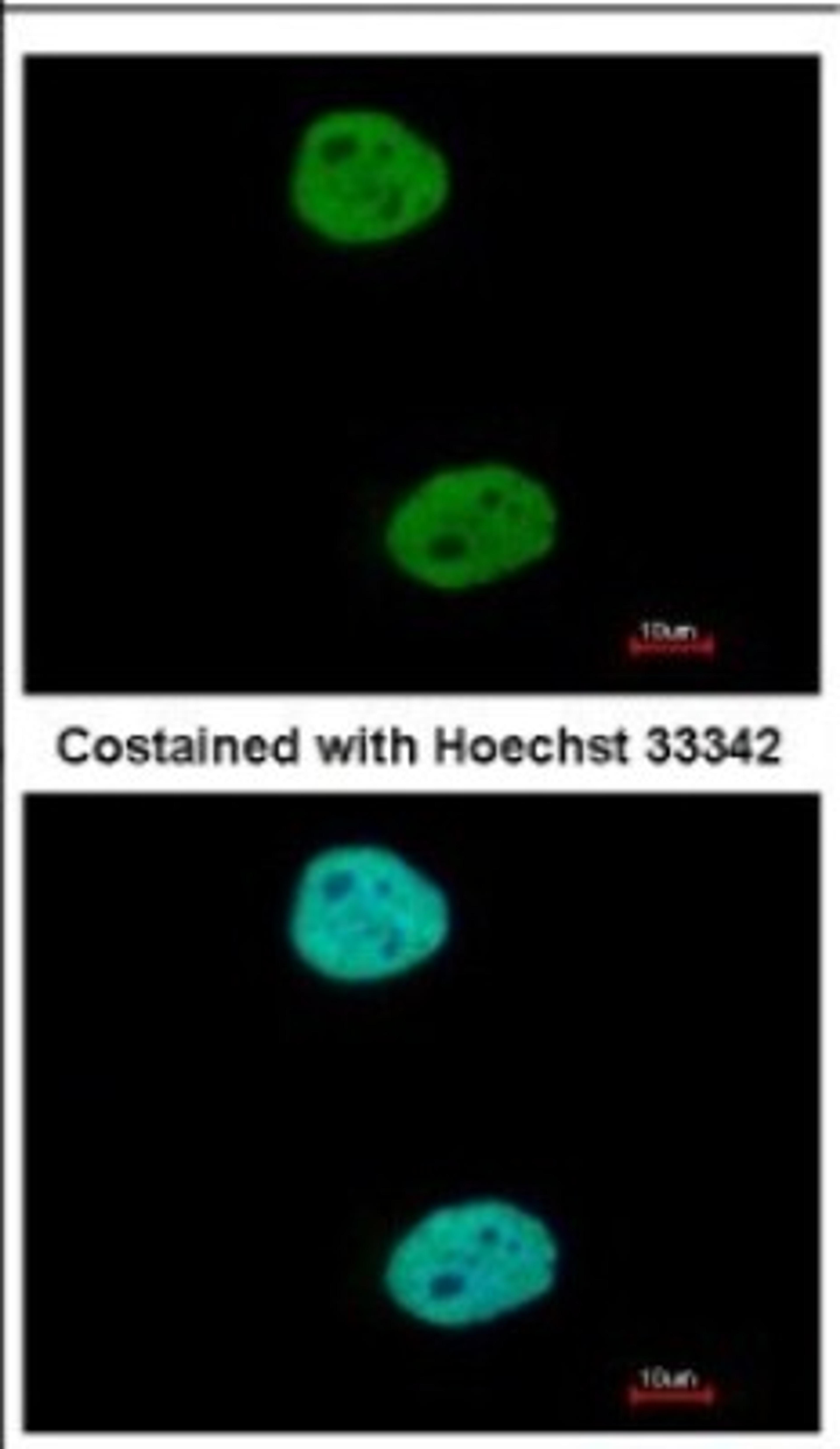 Immunocytochemistry/Immunofluorescence: GTF3C4 Antibody [NBP2-16763] - Immunofluorescence analysis of paraformaldehyde-fixed HeLa, using antibody at 1:500 dilution.