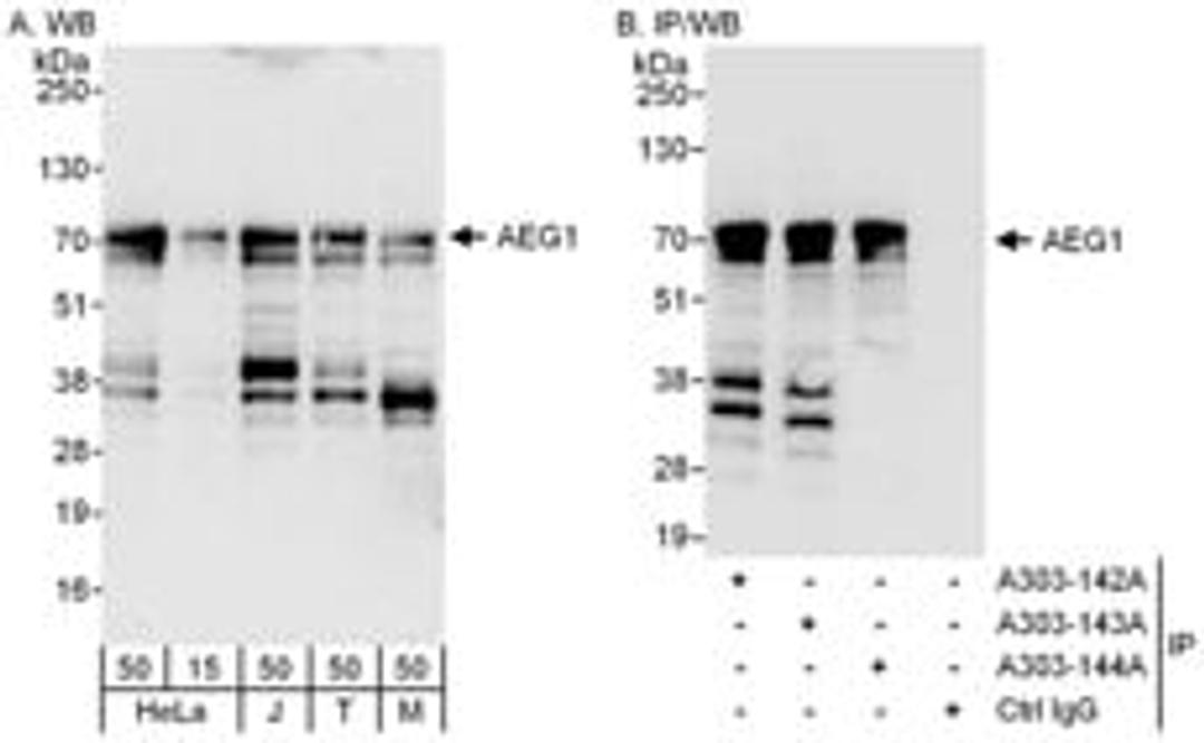 Detection of human and mouse AEG1 by western blot (h & m) and immunoprecipitation (h).