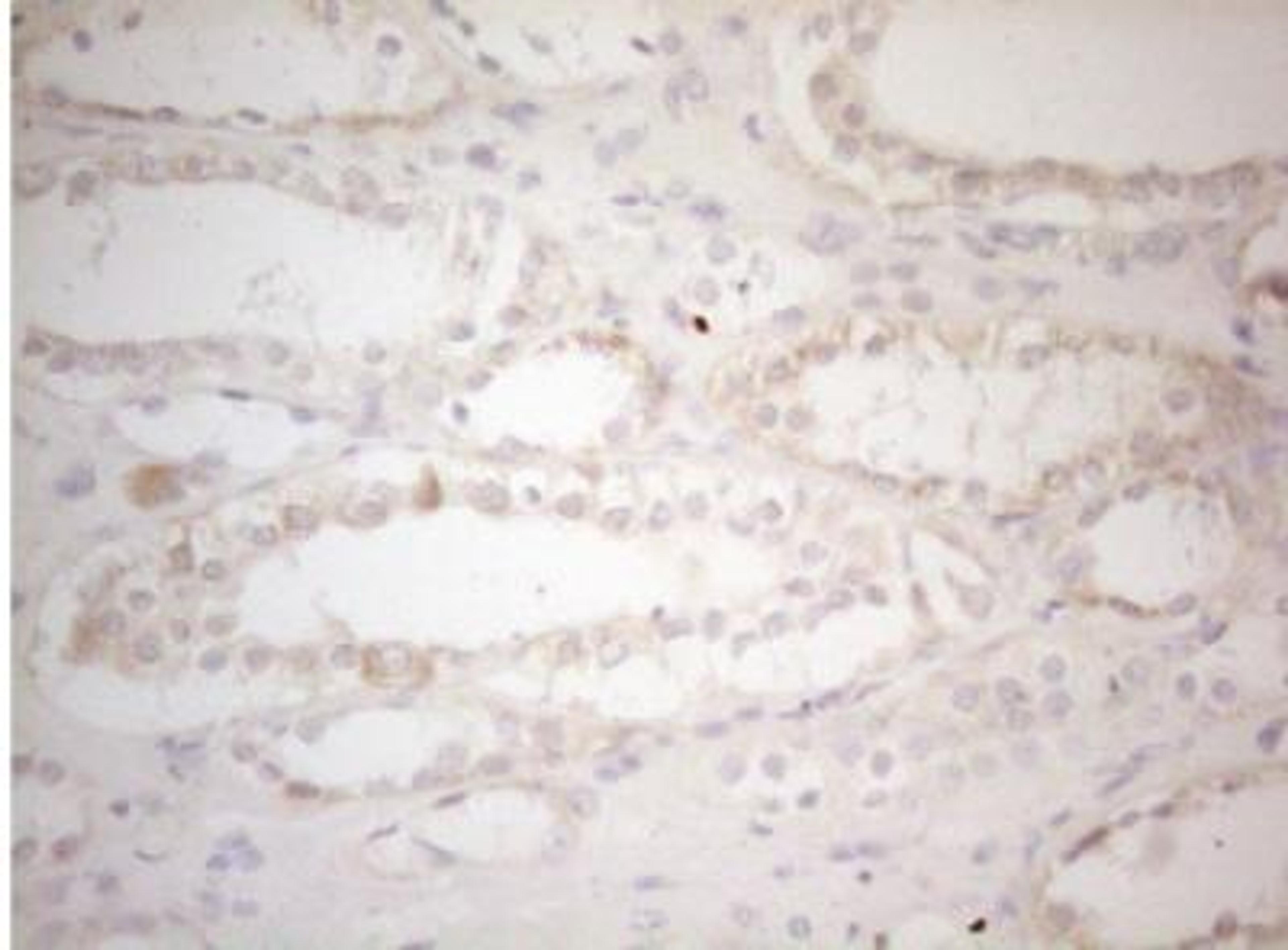 Immunohistochemistry-Paraffin: MAD4 Antibody (7F7) [NBP2-46060] - Paraffin-embedded human Kidney tissue within the normal limits using antiMXD4 mouse monoclonal antibody. (Heat-induced epitope retrieval by 1mM EDTA in 10mM Tris buffer  (pH8.5) at 120 C for 3 min, (1:150)