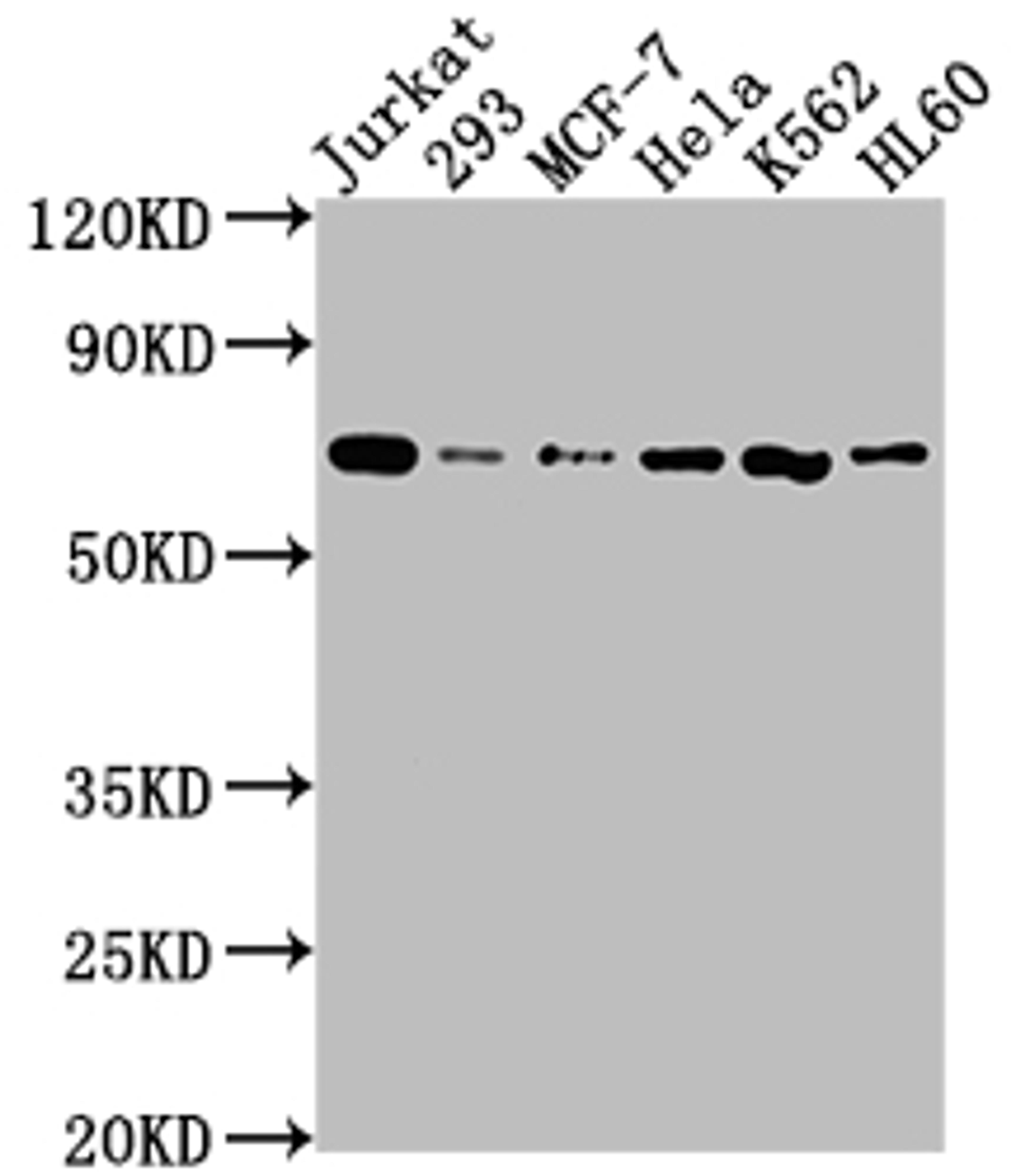 Western Blot. Positive WB detected in: Jurkat whole cell lysate, 293 whole cell lysate, MCF-7 whole cell lysate, Hela whole cell lysate, K562 whole cell lysate, HL60 whole cell lysate. All lanes: PTPN11 antibody at 1:2000. Secondary. Goat polyclonal to rabbit IgG at 1/50000 dilution. Predicted band size: 69, 53 kDa. Observed band size: 69 kDa. 