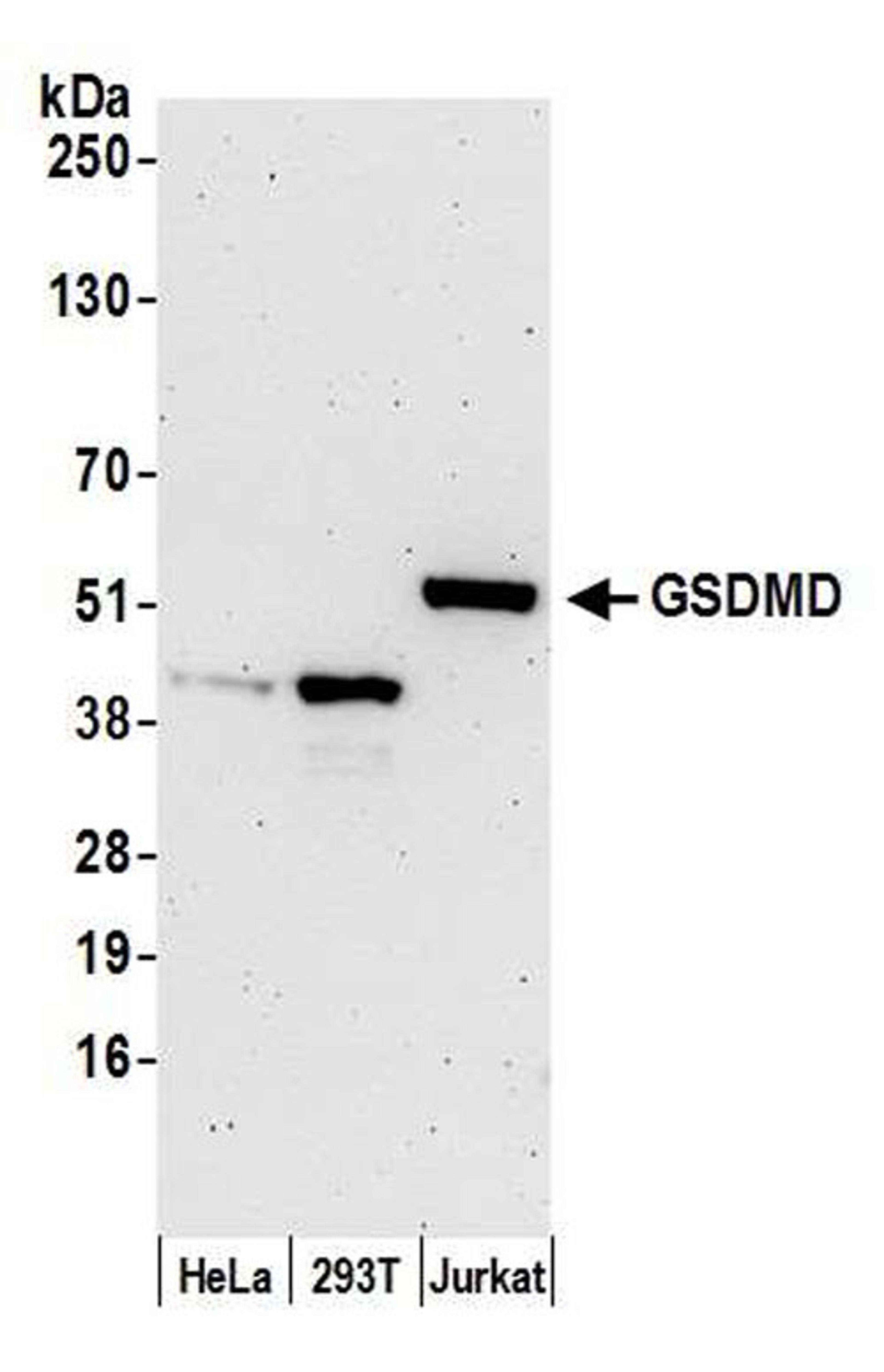 Detection of human GSDMD by WB.