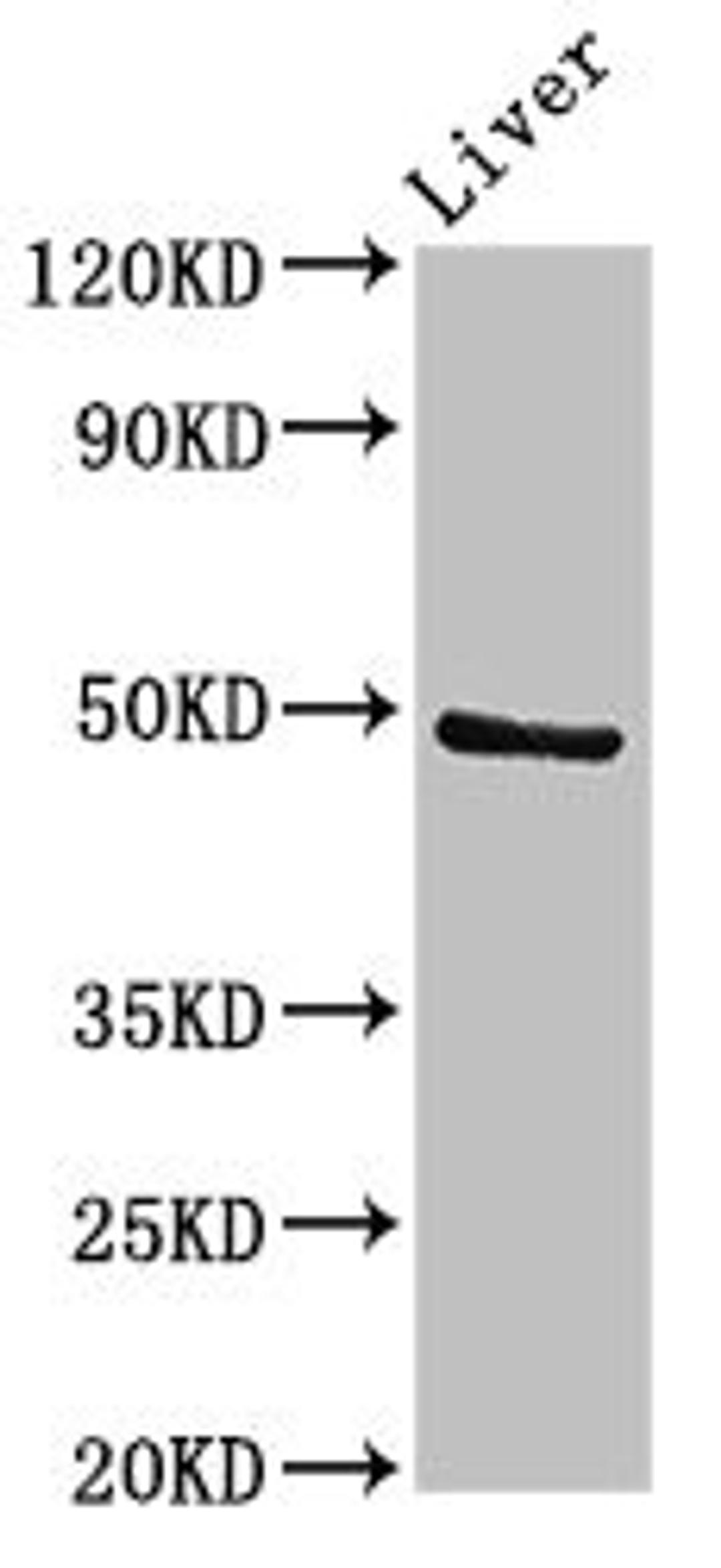Western Blot. Positive WB detected in: Rat liver tissue. All lanes: PACSIN3 antibody at 2.7ug/ml. Secondary. Goat polyclonal to rabbit IgG at 1/50000 dilution. Predicted band size: 49 kDa. Observed band size: 49 kDa. 
