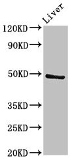 Western Blot. Positive WB detected in: Rat liver tissue. All lanes: PACSIN3 antibody at 2.7ug/ml. Secondary. Goat polyclonal to rabbit IgG at 1/50000 dilution. Predicted band size: 49 kDa. Observed band size: 49 kDa. 