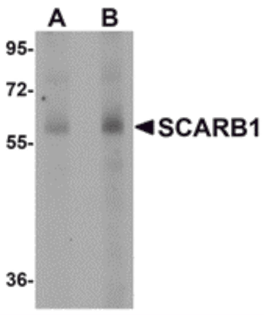 Western blot analysis of SCARB1 in human spleen tissue lysate with SCARB1 antibody at (A) 1 and (B) 2 &#956;g/mL.