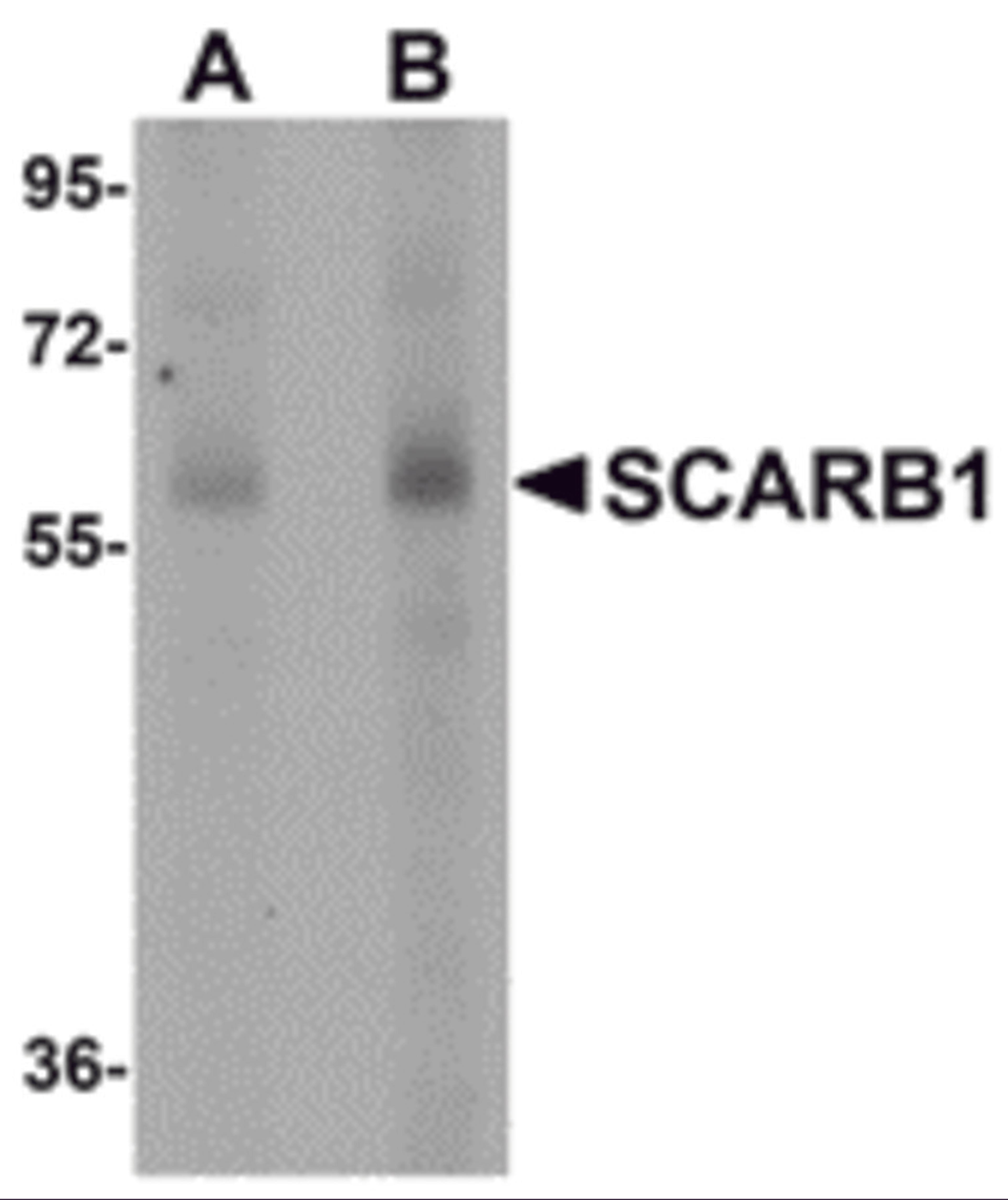 Western blot analysis of SCARB1 in human spleen tissue lysate with SCARB1 antibody at (A) 1 and (B) 2 &#956;g/mL.