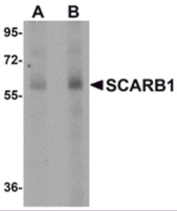 Western blot analysis of SCARB1 in human spleen tissue lysate with SCARB1 antibody at (A) 1 and (B) 2 μg/mL.