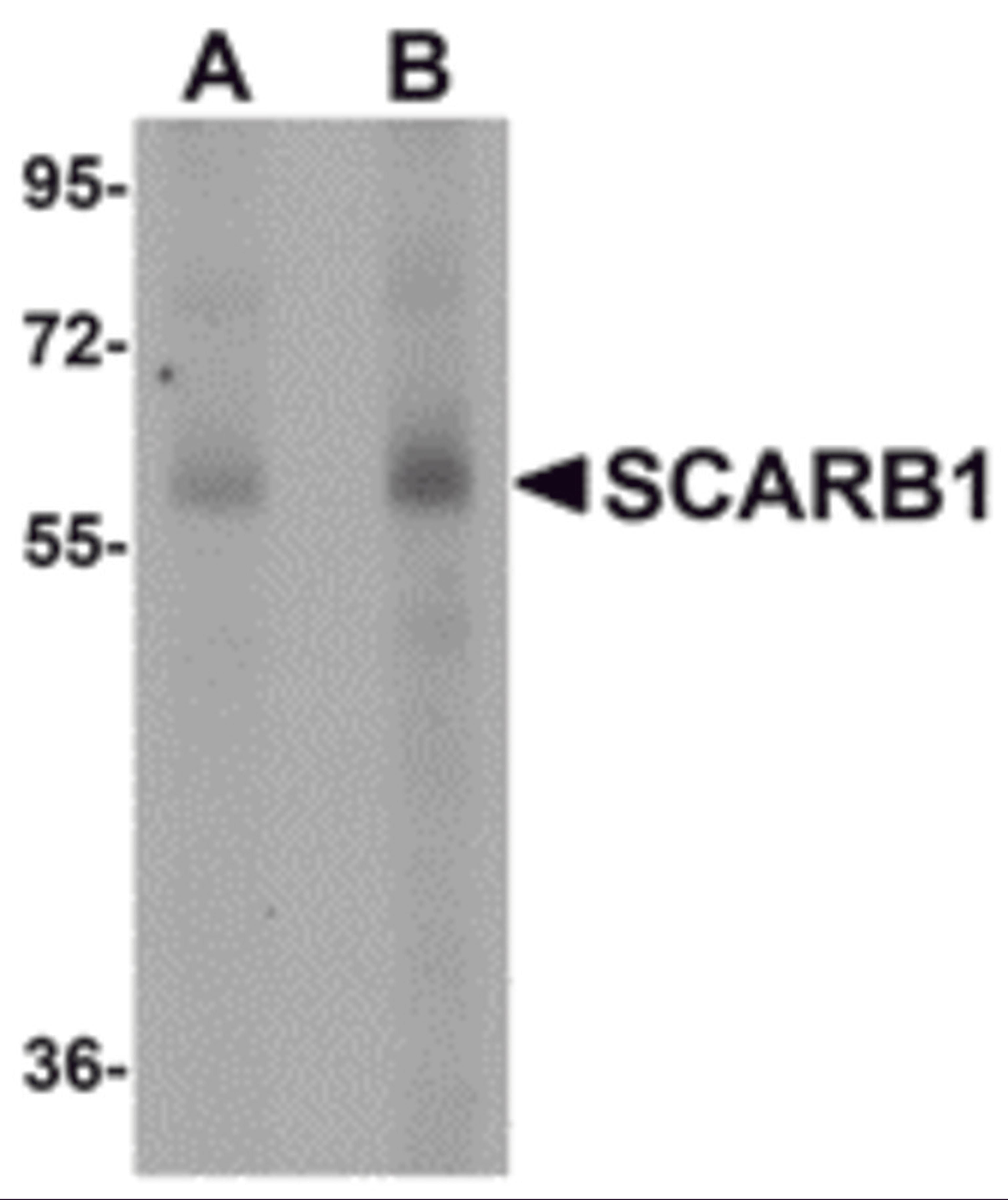 Western blot analysis of SCARB1 in human spleen tissue lysate with SCARB1 antibody at (A) 1 and (B) 2 μg/mL.