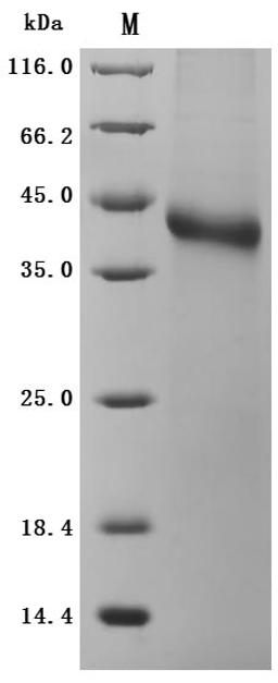 (Tris-Glycine gel) Discontinuous SDS-PAGE (reduced) with 5% enrichment gel and 15% separation gel.