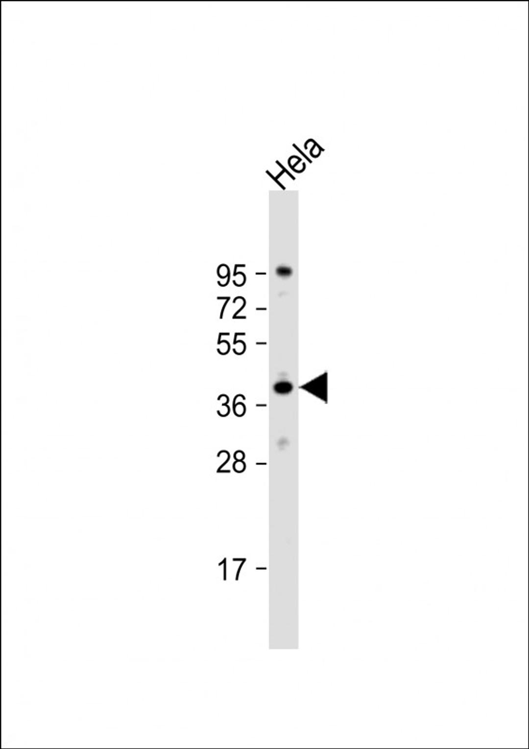 Western Blot at 1:2000 dilution + Hela whole cell lysate Lysates/proteins at 20 ug per lane.