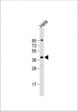 Western Blot at 1:2000 dilution + Hela whole cell lysate Lysates/proteins at 20 ug per lane.