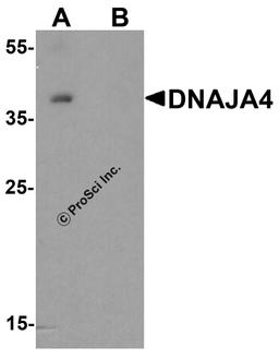 Western blot analysis of DNAJA4 in human colon tissue lysate with DNAJA4 antibody at 1 μg/ml in (A) the absence and (B) the presence of blocking peptide.