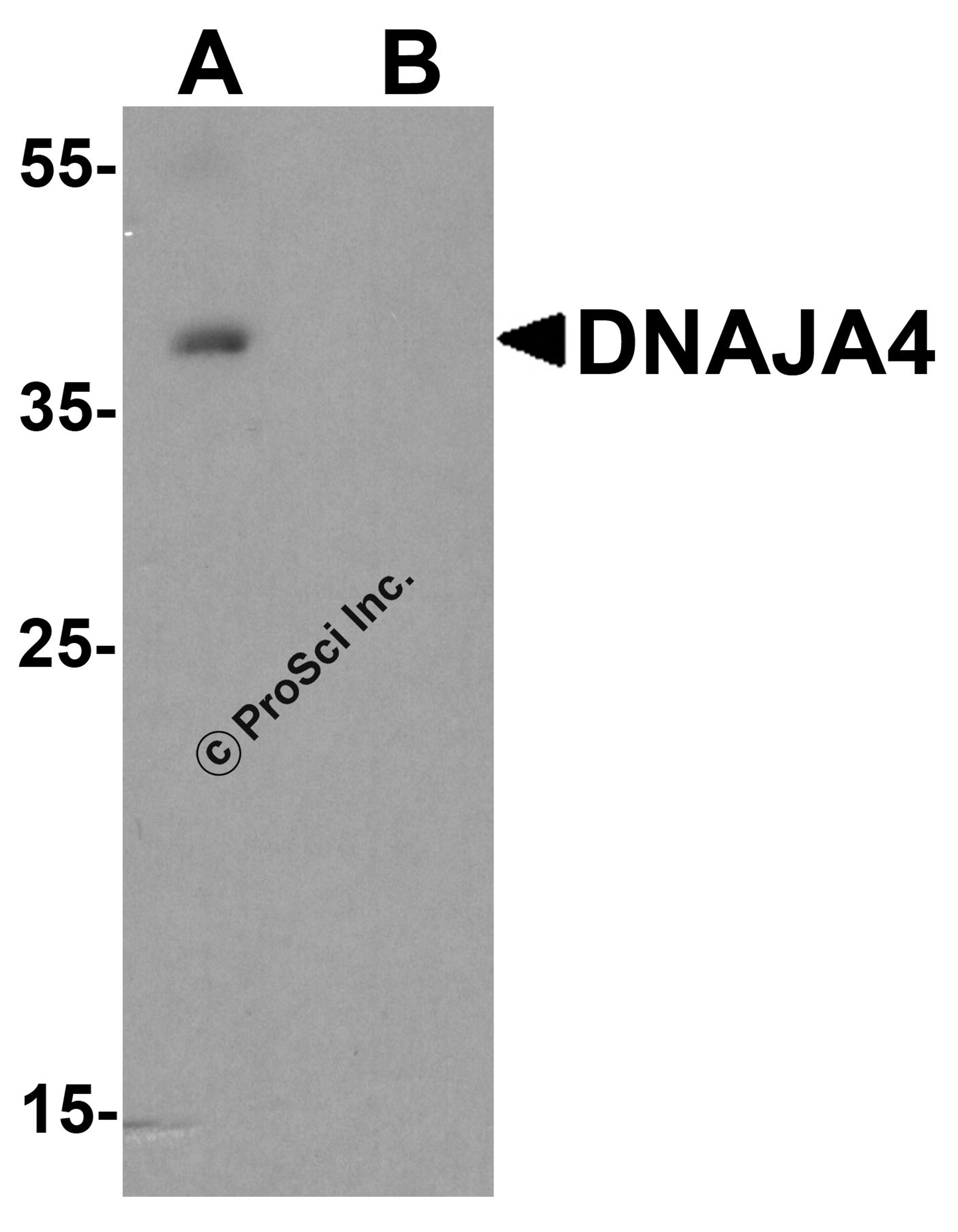 Western blot analysis of DNAJA4 in human colon tissue lysate with DNAJA4 antibody at 1 μg/ml in (A) the absence and (B) the presence of blocking peptide.