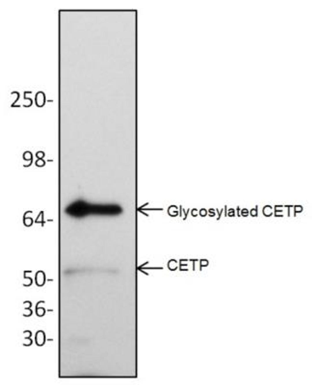 Western Blot: CETP Antibody [NBP1-45478] - Jurkat cell lysate (60 ug).