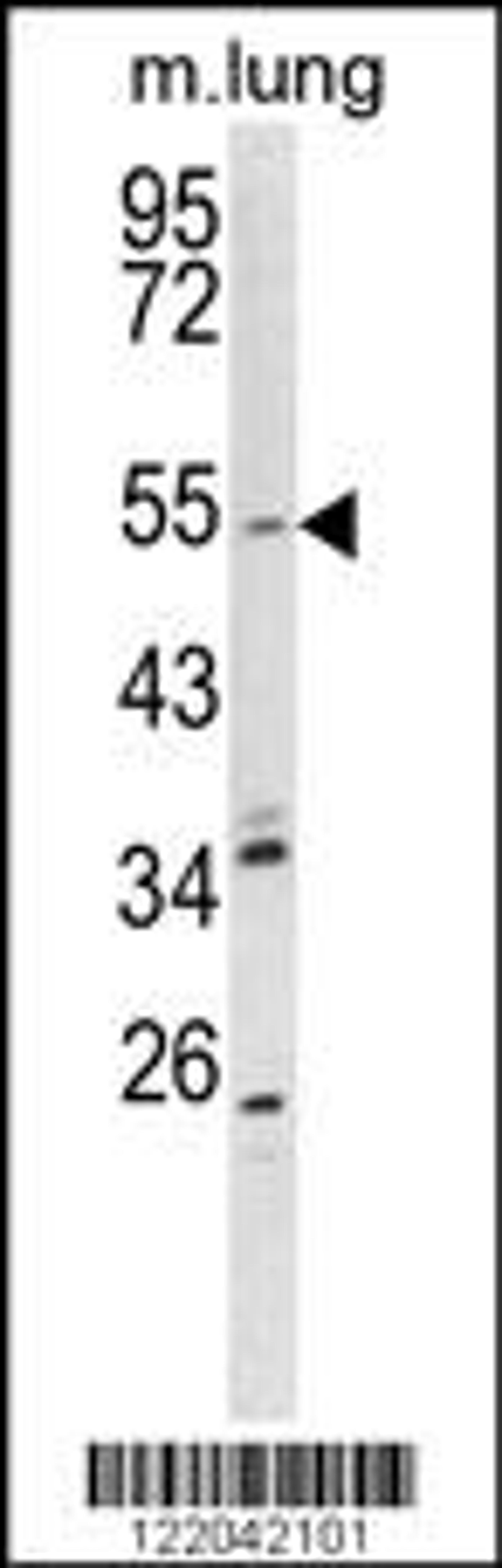 Western blot analysis of KCNQ1 Antibody in mouse lung tissue lysates (35ug/lane)